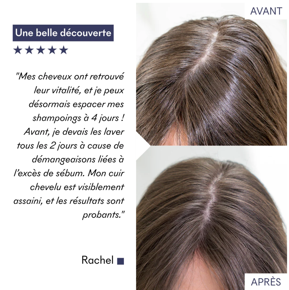 Shampoing TRICHO DÉTOX – Shampooing Cheveux Gras pH5